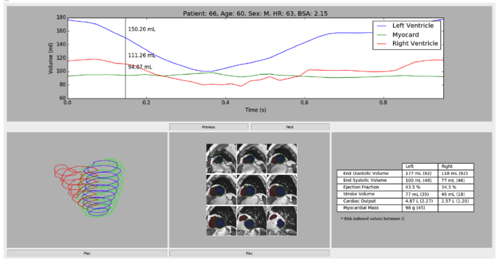 deep learning
